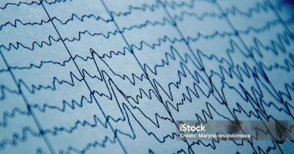 EEG