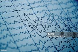 EEG